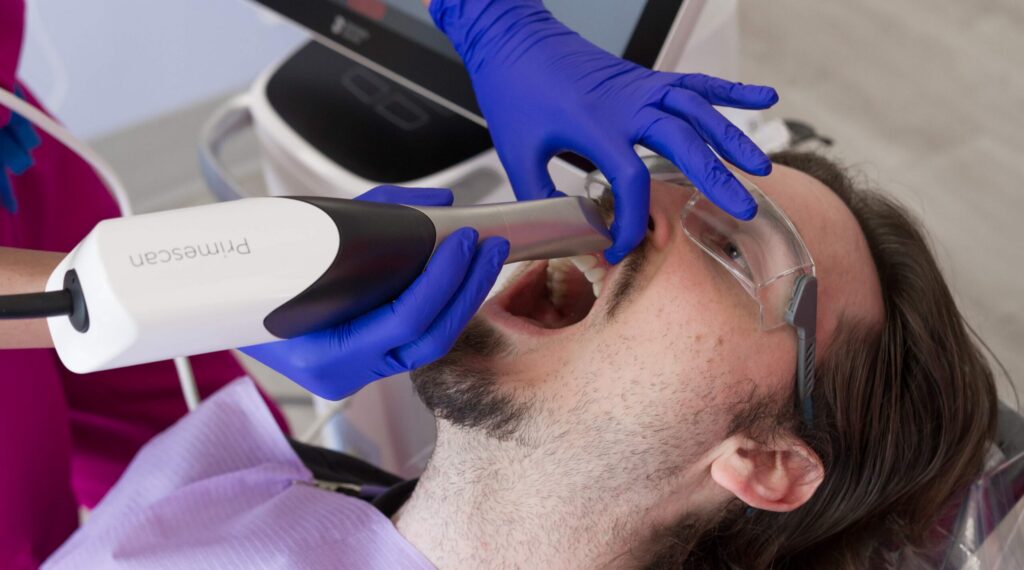 Do You Need a Crown After Root Canal Treatment in NW Calgary? What You Need to Know